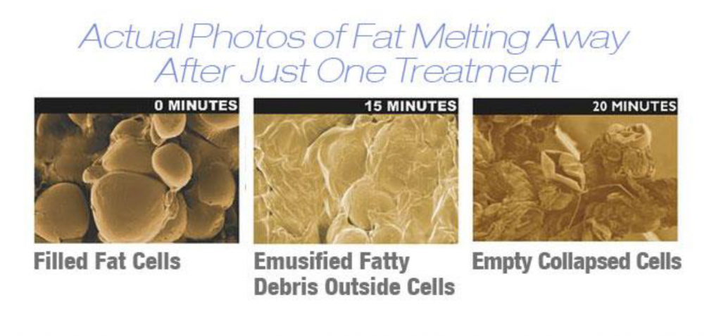 SkinnyLight Red Light Therapy